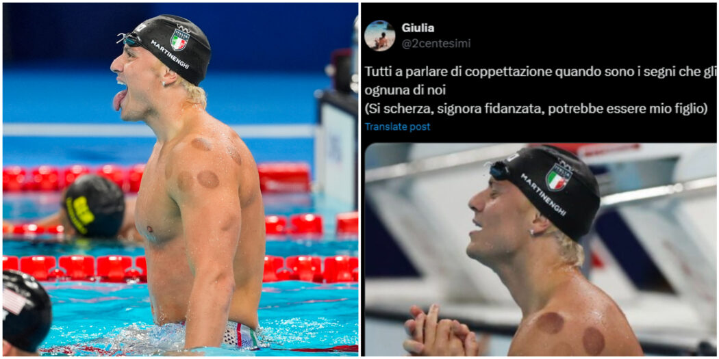 “Sono i segni di una fellatio?”, “è una magia nera”, “pensavo fossero lamprede”: il web scatenato sulla coppettazione alle Olimpiadi 2024