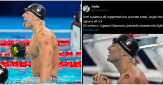 Copertina di “Sono i segni di una fellatio?”, “è una magia nera”, “pensavo fossero lamprede”: il web scatenato sulla coppettazione alle Olimpiadi 2024