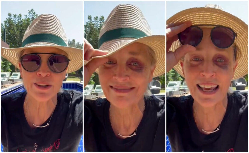 Sharon Stone e il misterioso occhio nero in Turchia: “Questo viaggio è stato duro, ma io sono più dura”