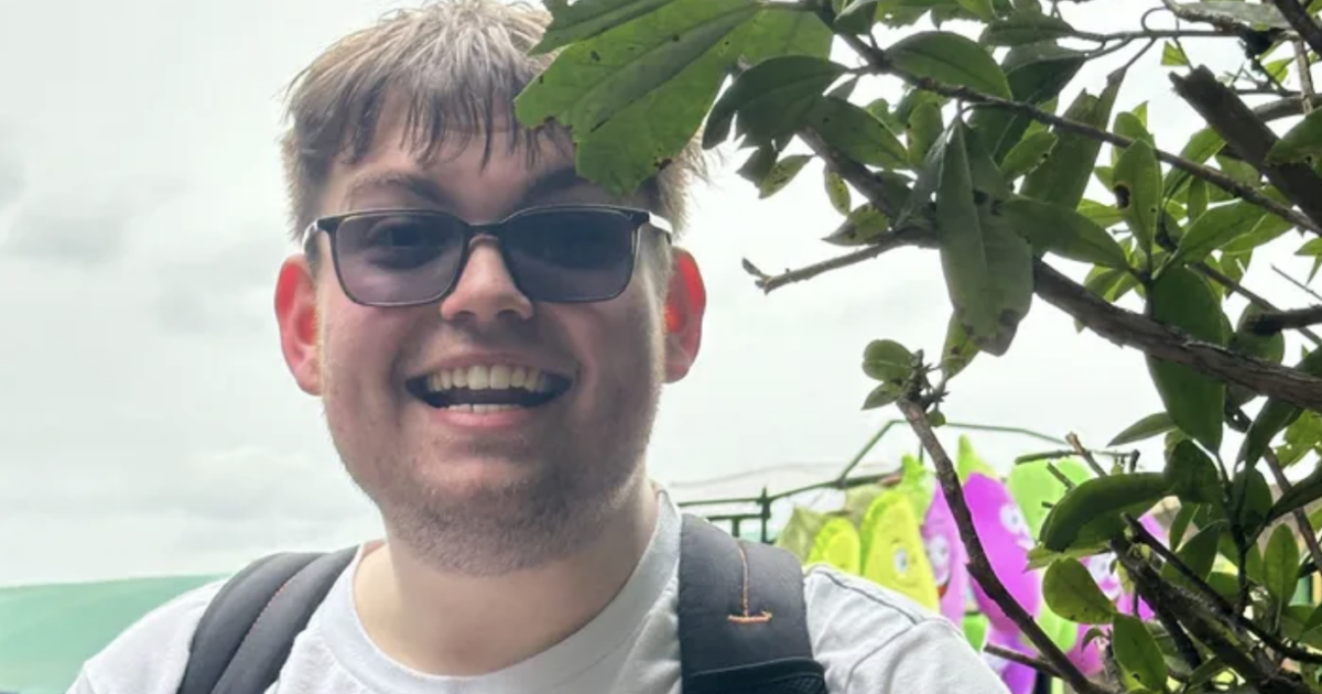 Studente universitario curato per una grave scottatura solare muore per 25 minuti, poi la scoperta sorprendente: ecco cos’è successo
