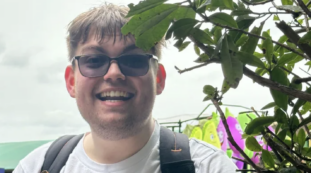 Copertina di Studente universitario curato per una grave scottatura solare muore per 25 minuti, poi la scoperta sorprendente: ecco cos’è successo