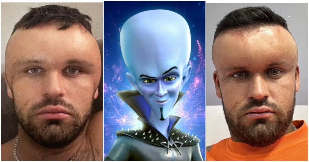 Si tinge i capelli ma qualcosa va storto: “Sembravo Megamind, avevo la testa a palloncino. Il mio cuoio capelluto è pieno di croste gialle e verdi”