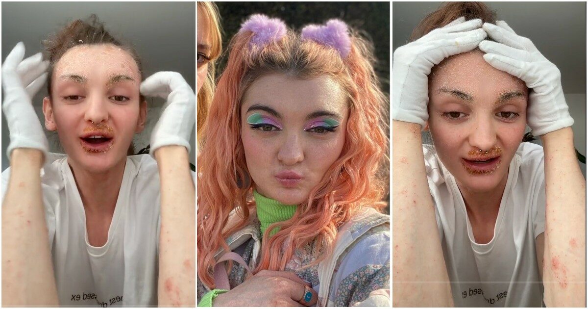 “Sto così male che in certi giorni che non mi sento nemmeno un essere umano”: l’urlo di dolore di Anthony Lexa di Sex Education, affetta da TSW
