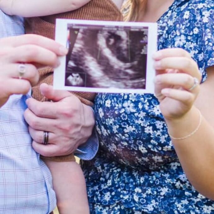 Mamma partorisce due gemelle siamesi con un solo cuore, ma vivono solo un’ora: “Mi hanno offerto di abortire, ma volevo incontrarle”