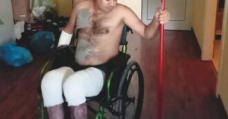 Copertina di Umar, respinto e picchiato 36 volte in Croazia. A Trieste ha diritto di asilo (ma non alle cure)