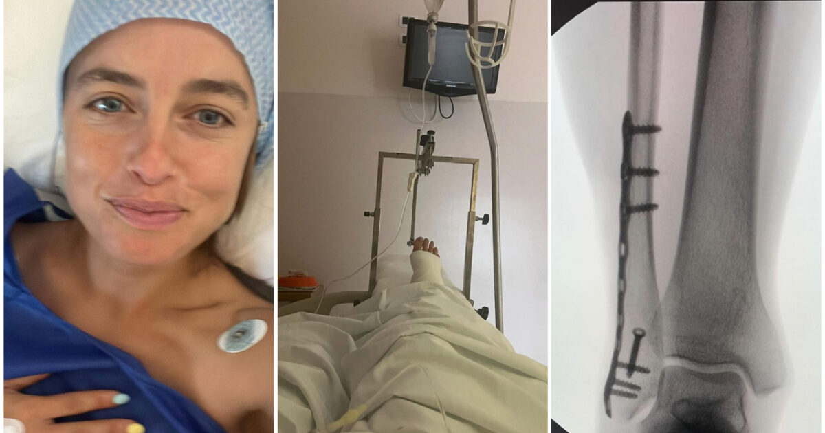 Matilde Gioli ricoverata in ospedale con la gamba rotta: “Starò a riposo per un pò. Se vi va scrivetemi titoli di libri e film preferiti”