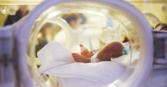 Copertina di Neonata salvata con la colla acrilica, operata con una tecnica innovativa al Regina Margherita di Torino