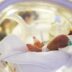 Copertina di Neonata salvata con la colla acrilica, operata con una tecnica innovativa al Regina Margherita di Torino