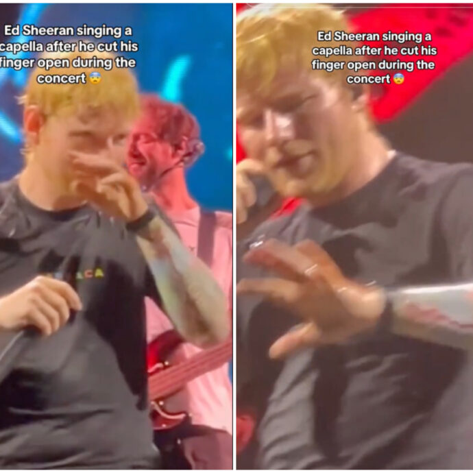 Ed Sheeran sanguina sul palco, si taglia un dito con la chitarra durante il concerto: “Farò il primo soccorso mentre canto la prossima canzone” (IL VIDEO)