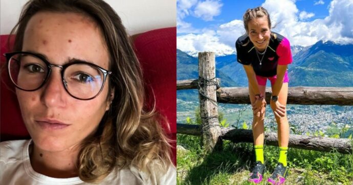 “Sono stata assalita dalle vespe, una scena da incubo. E non sapevo degli effetti del veleno”: il racconto di Alba De Silvestro, campionessa di scialpinismo