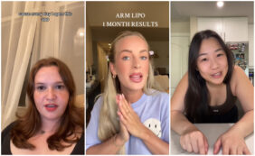 Copertina di Le braccia sottili sono la nuova ossessione beauty di TikTok: l’era della body positivity è già finita?