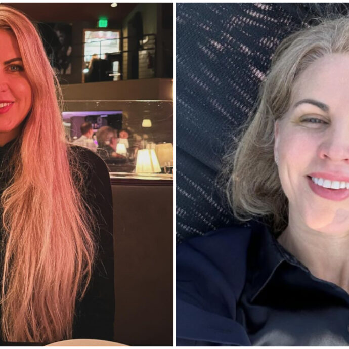 Da 53 anni a 25 biologici: Liz Parrish è la prima donna ad esser ringiovanita con la terapia genetica