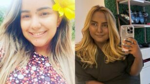 Copertina di “Più il tumore avanza più la mia pelle diventa scura”: l’odissea di Sabrina, 24enne affetta da un raro timoma. Ecco cos’è la sindrome di Cushing