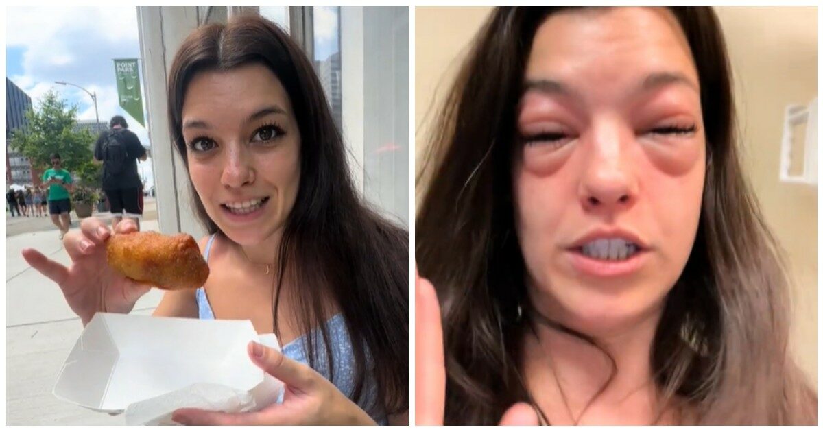 Influencer gonfia come una zampogna, tradita dai cetriolini: “Strano, sono una grande amante dei sottaceti”. Ecco cos’è successo