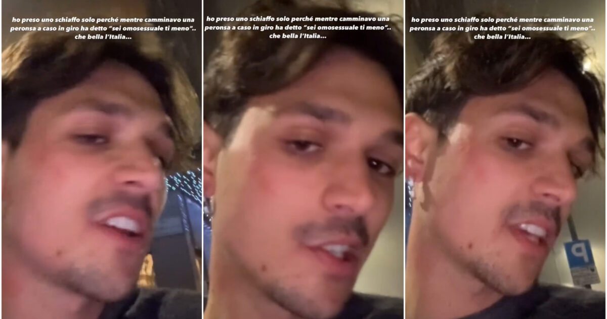 “Ho preso uno schiaffo perché omosessuale. Questa è Milano. Sono stanco di questa omofobia che c’è in Italia”: la denuncia del TikToker Sespo sui social