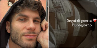 Copertina di “Segni di guerra, ho vinto”: Samuele Carniani di Uomini e Donne mostra le ferite dell’intervento contro il tumore