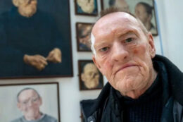 Copertina di Una crosticina sul naso, poi la scoperta choc: “Era un raro tumore testa-collo, mi hanno asportato il naso, un occhio, parte della guancia e i denti. Ora vivo con una protesi facciale”