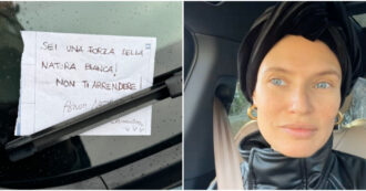 Copertina di “Sei una forza della natura, non ti arrendere!”: Bianca Balti legge un bigliettino commovente di un fan anonimo lasciato sul parabrezza della sua auto