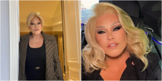 Copertina di È morta a 84 anni Jocelyn Wildenstein: la “donna gatto” era diventata famosa per i suoi numerosi interventi di chirurgia plastica estrema
