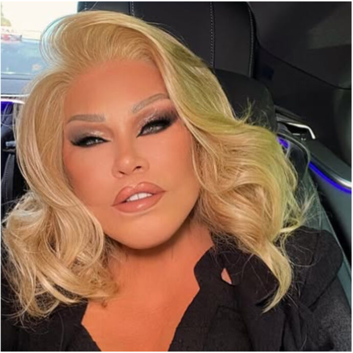 È morta a 84 anni Jocelyn Wildenstein: la “donna gatto” era diventata famosa per i suoi numerosi interventi di chirurgia plastica estrema