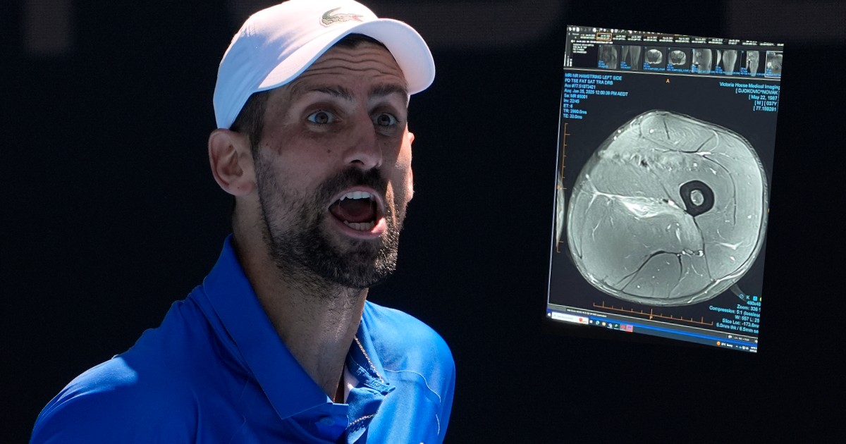 Djokovic pubblica la risonanza magnetica alla coscia: "Ho pensato di  lasciarla qui per tutti gli 'esperti' di infortuni là fuori" - Foto - Il  Fatto Quotidiano