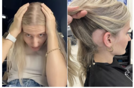 Copertina di “Ho chiazze calve in testa ma la vita non finisce quando perdi i capelli”: la storia di Wayde Cadogan, che a 20 anni ha scoperto di avere l’alopecia areata