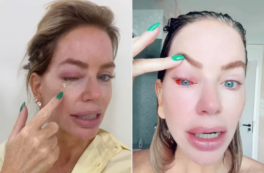 Copertina di “Sembra che mi stia per scoppiare l’occhio, è come se il bulbo oculare stesse bruciando”: il calvario di Caroline Stanbury, star di “Real Housewives”