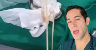Copertina di “Attenzione, non è la soluzione giusta per perdere peso”: verme solitario lungo “fino a 9 metri” estratto dallo stomaco di una paziente