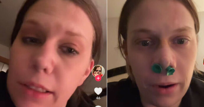 “Il mio naso ha iniziato a sanguinare e perdere pezzi di pelle. Poi mi si è formato un buco in faccia”: ecco cos’è il coke nose. La storia di Kelly