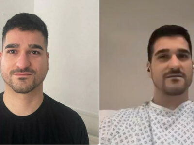 Copertina di “Mi sono svegliato con il viso gonfio, per i medici era parotite invece è un cancro al quarto stadio. Sono condannato a morte”: la storia di George Dudnik