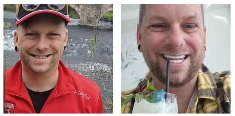 “Consumavo 21 lattine di bibite gassate a settimana e non andavo dal dentista da 10 anni. Un giorno mi è caduto un dente all’improvviso e ho deciso di andare in Turchia”: la storia di Nicholas Mudford