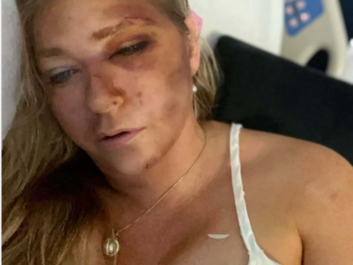 “Non posso più restare in silenzio”: dopo il giallo dell’incidente, Virginia Giuffre torna a parlare e racconta gli abusi subiti dal marito