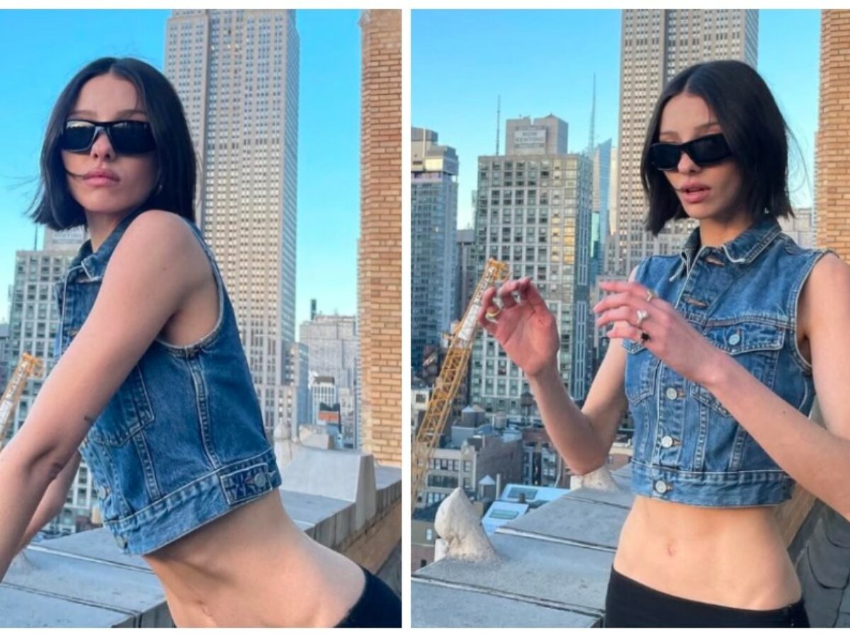 È morta Lucy Markovic, star di Australia’s Next Top Model. Aveva malformazione artero-venosa cerebrale “delle dimensioni di una pallina da golf”