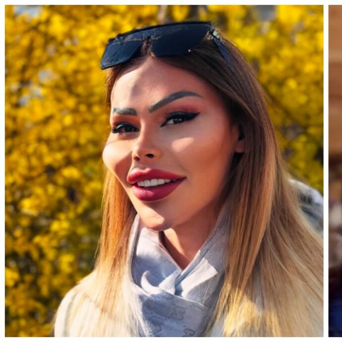 “Voglio gli zigomi più grandi del mondo. Ho speso più di 70mila euro per 100 interventi di chirurgia estetica”: la confessione di Patrick Mast