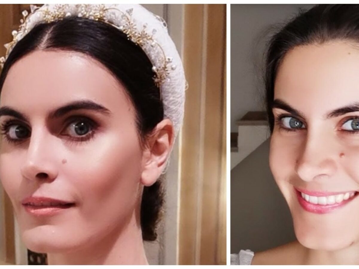 “Ho la malattia delle gambe di legno, ma è sconosciuta all’INPS. Mi impedisce di fare tutto”: la disperazione dell’ex modella Rossella Moretti