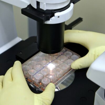 Copertina di Parkinson, “le cellule staminali hanno ridotto i tremori”. Due studi pubblicati su Nature