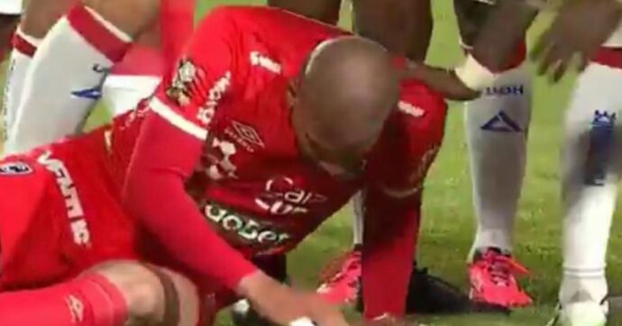 Perde tre denti e si frattura la mascella, ma per l’arbitro è solo cartellino giallo. Polemica nel campionato peruviano