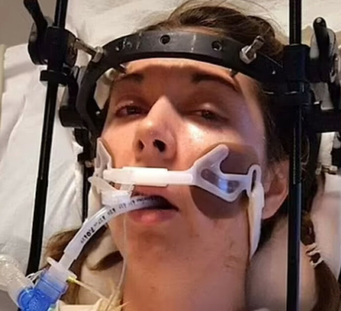 I medici le riattaccano il cranio dopo una brutta caduta: “Un orrore. Ora sono una statua umana, non posso più muovere la testa”. La storia di Megan King