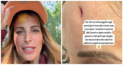 Copertina di “Una mazza da minigolf ha colpito la mia testa al posto della pallina. Ho un taglio che ha raggiunto l’osso”: il racconto di ClioMakeUp