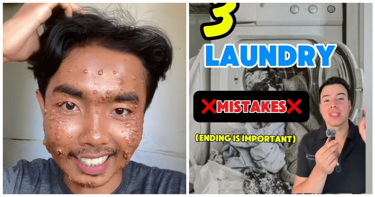 “Ho indossato i vestiti comprati in un negozio dell’usato, ma senza lavarli. Ora ho un’infezione della pelle”: l’avvertimento del tiktoker