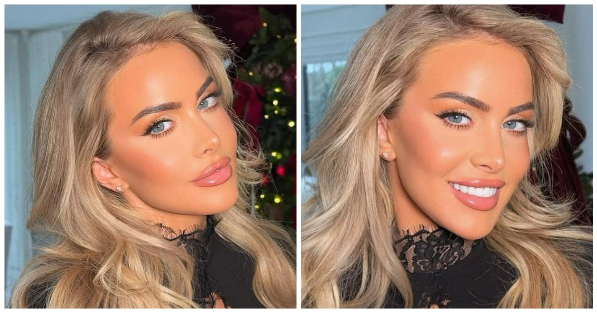 “Ho fatto così tanti ritocchi estetici che il mio passaporto non funziona ai gate elettronici degli aeroporti”, il surreale racconto dell’influencer Ashley Stobart