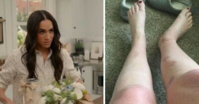 Copertina di “Ulcere, scottature e dolori lancinanti dopo aver provato i sali da bagno di Meghan Markle”: donna le fa causa per 10 milioni. La replica dei legali: “Accuse non valide”