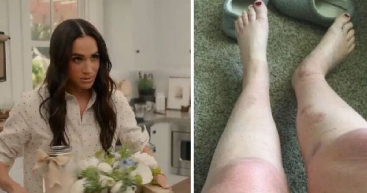 ulcere scottature e dolori lancinanti dopo aver provato i sali da bagno di meghan markle donna le fa causa per 10 milioni la replica dei legali accuse non valide da Ilfattoquotidiano.it ulcere scottature e dolori lancinanti dopo aver provato i sali da bagno di meghan markle donna le fa causa per 10 milioni la replica dei legali accuse non valide