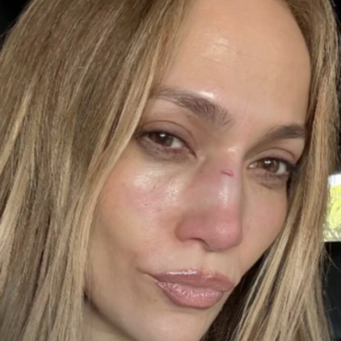 “Grazie per avermi ricucita”: ha un incidente e si ferisce al naso, Jennifer Lopez corre dal chirurgo plastico