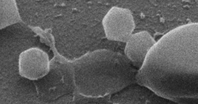 Copertina di Scoperto il primo “virus gigante” al mondo: “È grande il doppio del Covid, non sappiamo ancora i rischi per l’uomo”. L’analisi dell’esperto