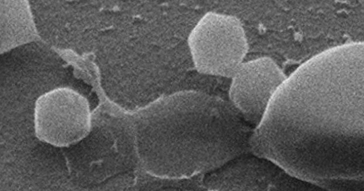 Scoperto il primo “virus gigante” al mondo: “È grande il doppio del Covid, non sappiamo ancora i rischi per l’uomo”. L’analisi dell’esperto Scoperto il primo “virus gigante” al mondo: “È grande il doppio del Covid, non sappiamo ancora i rischi per l’uomo”. L’analisi dell’esperto
