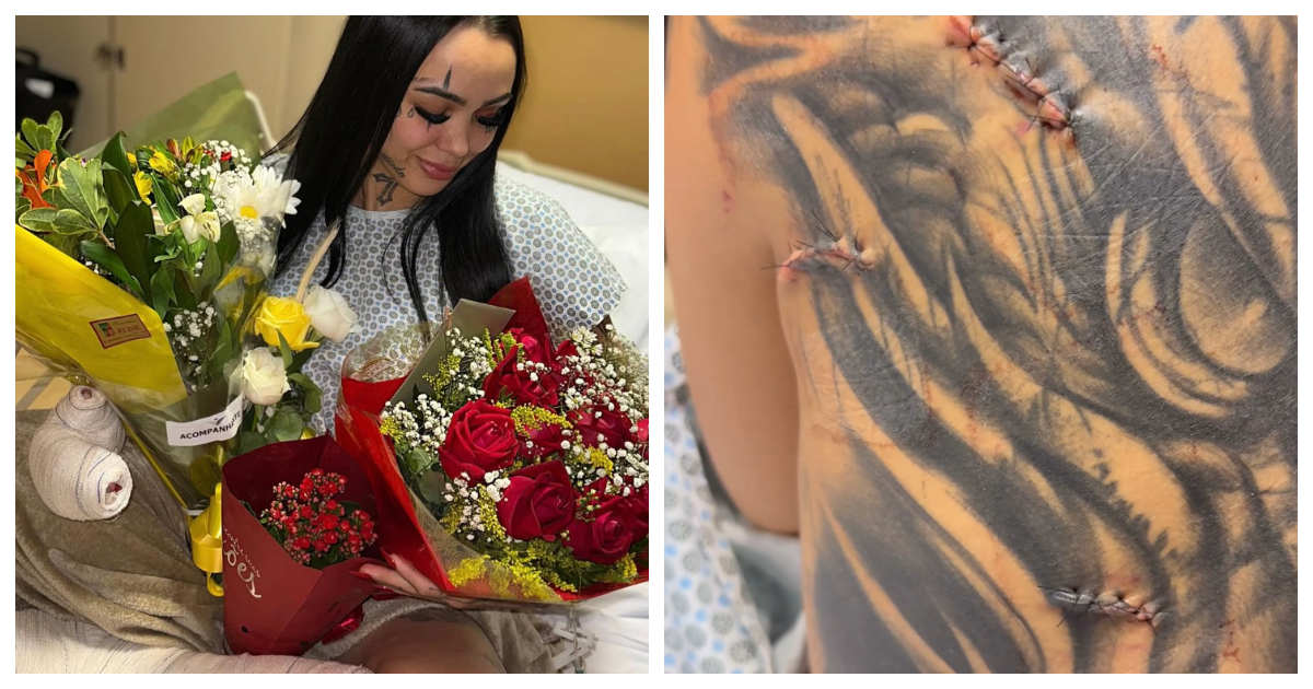 “Sono sopravvissuta a 10 coltellate, un miracolo. Dio mi ha dato un’altra possibilità”: l’influencer Luna ...