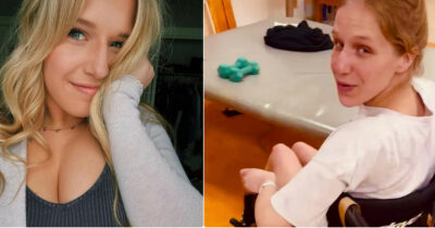 Copertina di “È come veleno per topi. Ho un sacco di zone morte nel cervello e ho dovuto reimparare a camminare”. Rachel Kelly inala “gas esilarante” per anni e rimane paralizzata