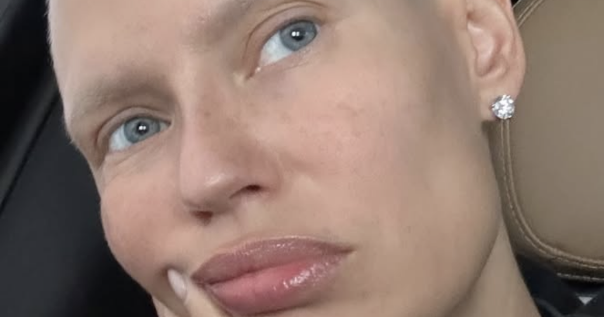 “Senza pillole salvavita contro il cancro non posso lavorare. È inaccettabile, datevi una mossa”: Bianca Balti si sfoga contro le industrie farmaceutiche