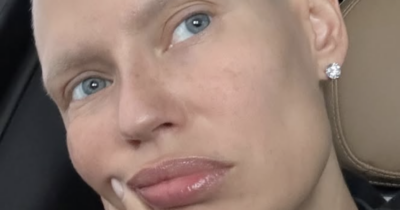 Copertina di “Senza pillole salvavita contro il cancro non posso lavorare. È inaccettabile, datevi una mossa”: Bianca Balti si sfoga contro le industrie farmaceutiche